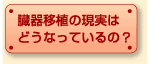 ڐǍ͂ǂȂẮH